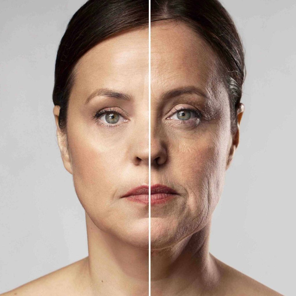 Imagen de Lifting facial
