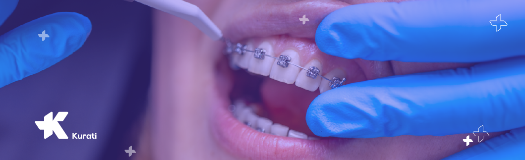 Imagen de Ortodoncia y brackets