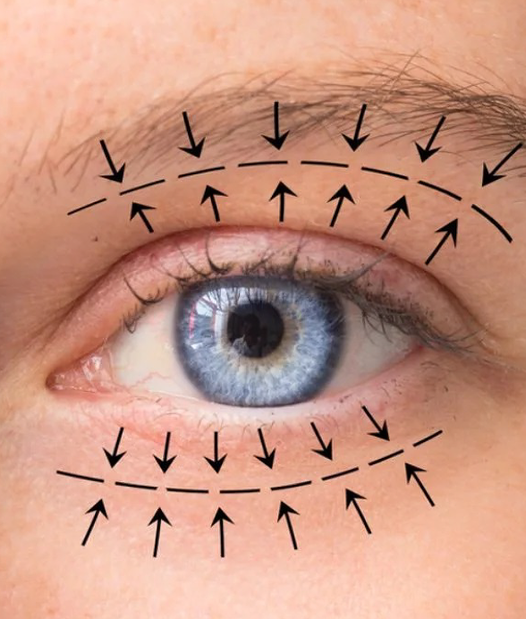 Imagen de Blefaroplastia