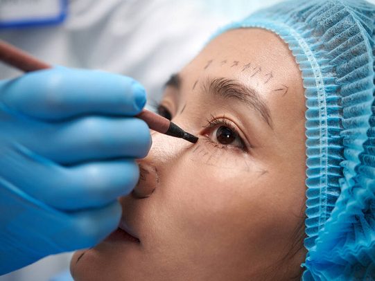 mujer en revisión para cirugía de blefaroplastia