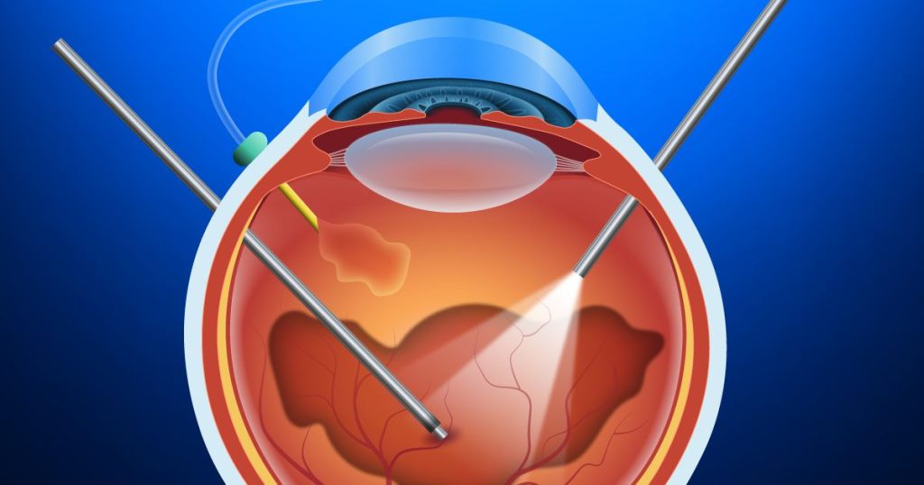 imagen vitectromia 01