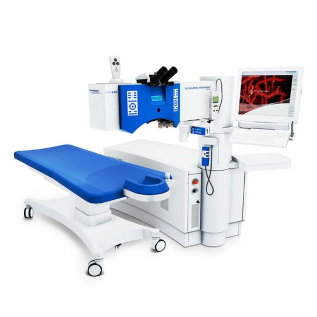 queratocono tecnologia laser queratocono tecnologia laser