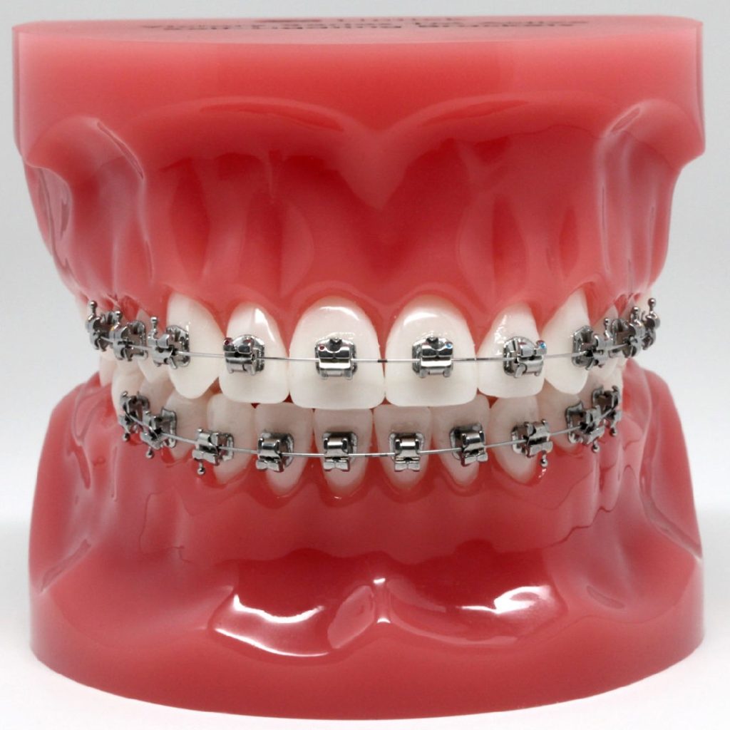 kurati brackets metálicos kurati brackets metálicos