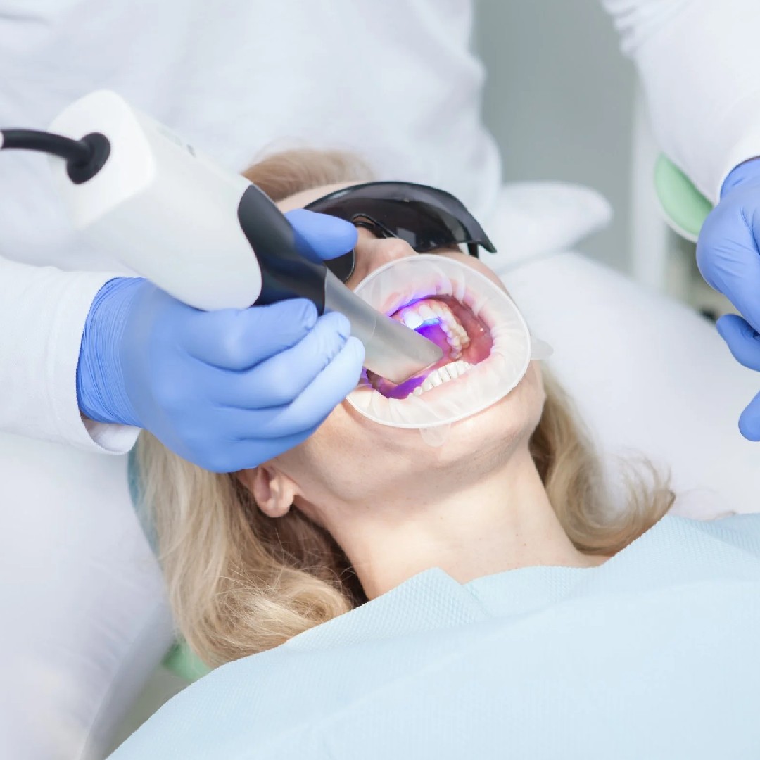 kurati escaneo intraoral