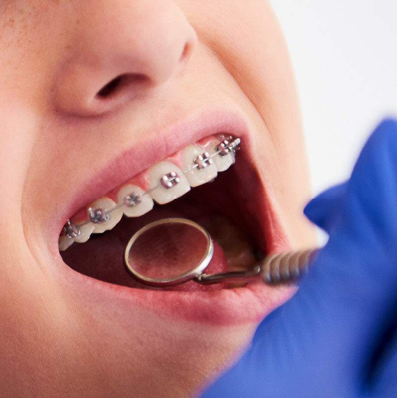 candidatos ortodoncia endodoncia