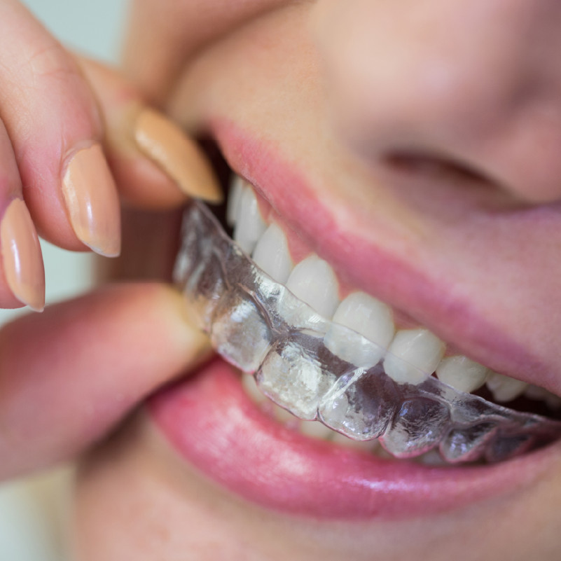 ortodoncia endodoncia